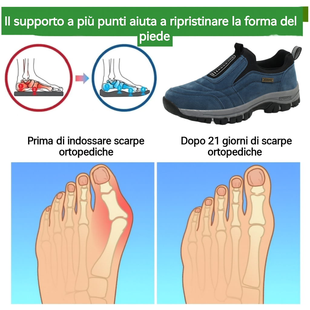 USERGOING® - Scarpe terapeutiche in pelle scamosciata ✅ Ortesi intelligenti + Risolve il dolore al tallone, la fascite e i dolori muscolari