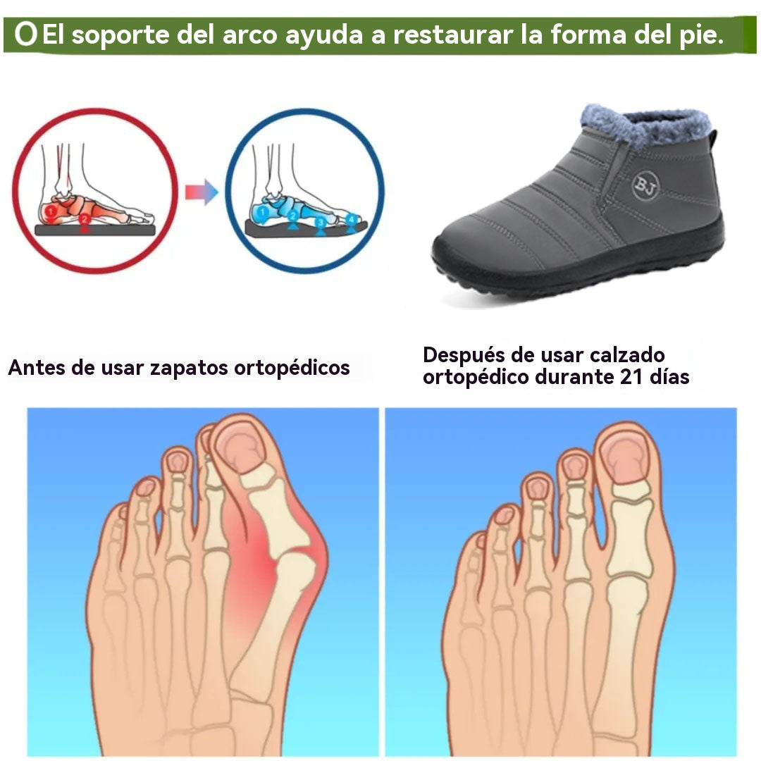Usergoing® | Stivali ortopedici di lusso in pelle scamosciata: antiscivolo e caldi, indispensabili per la neve. 👍 Di' addio al dolore ai piedi.