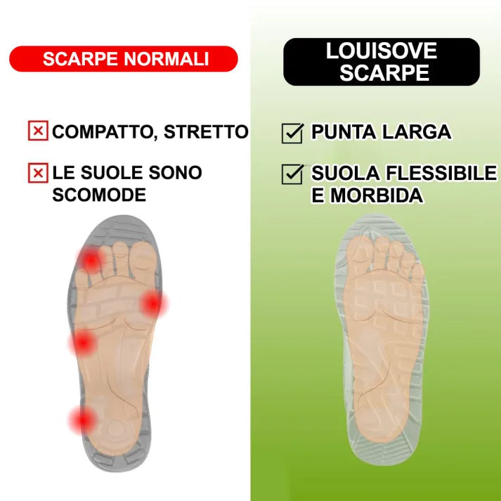 [🔥Oggi metà prezzo: da non perdere] Scarpe ortopediche da donna dal design ergonomico - design con supporto dell'arco plantare👞Sbarazzati facilmente del dolore ai piedi