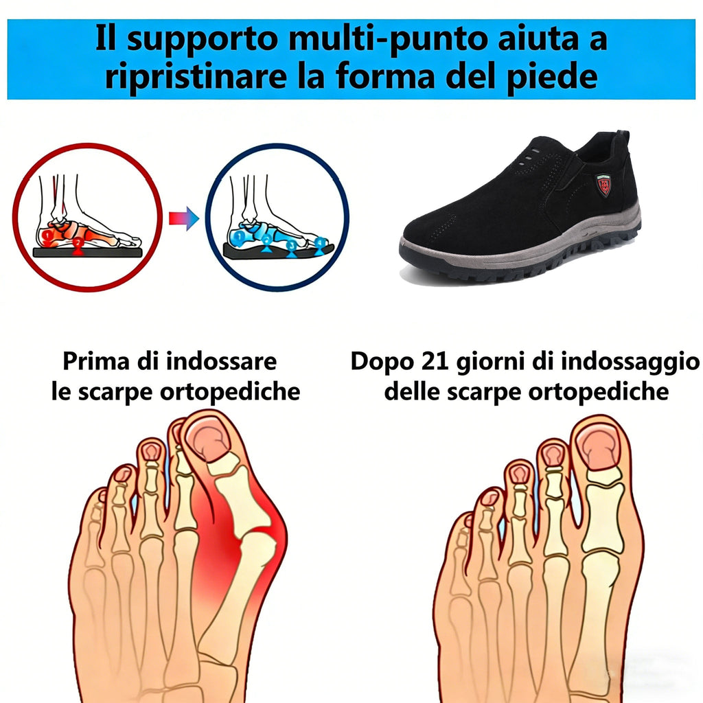 USERGOING® | Offerta a tempo limitato: 50% di sconto! Scarpe ortopediche casual unisex 👞! Queste scarpe ortopediche sono dotate di supporto ergonomico per l'arco plantare e suola antiscivolo per un comfort superiore!