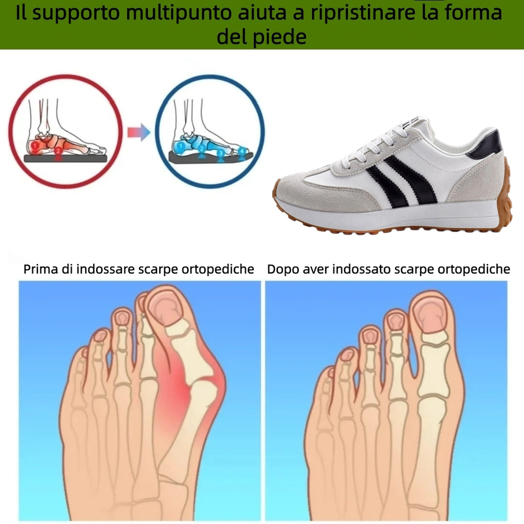 【⏰Ultimo giorno, 70% di sconto! Non perdete l'occasione!】Scarpe ortopediche ergonomiche con assorbimento degli urti, ✅️scarpe ortopediche salutari progettate specificamente per le donne europee.