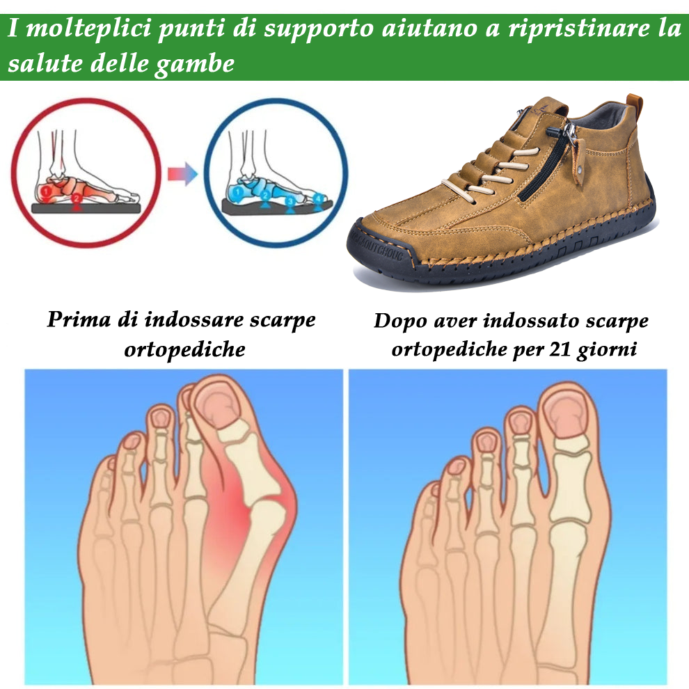 🔥 Sconto del 50% - Non lasciartelo sfuggire|Scarpe in Pelle "Zero Fatica": Zip Laterale, Supporto Plantare e suola antiscivolo – il design ergonomico allevia la fatica