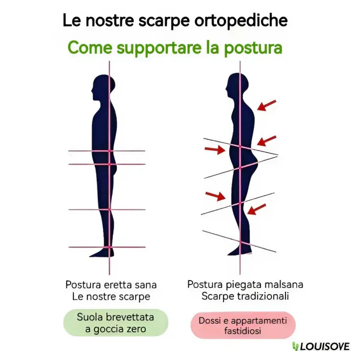 [🔥Oggi metà prezzo: da non perdere] Scarpe ortopediche da donna dal design ergonomico - design con supporto dell'arco plantare👞Sbarazzati facilmente del dolore ai piedi