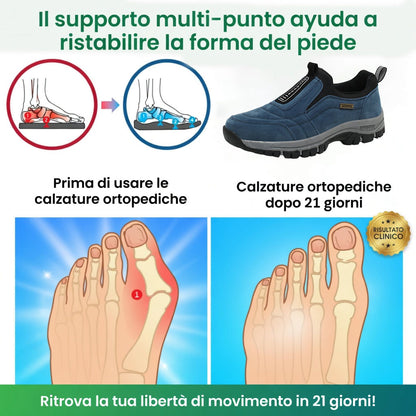 🎁Ultimo giorno per usufruire dello sconto del 50%, non perderlo! ⏰Allevia il dolore ai piedi e la fascite - Scarpe ortopediche impermeabili e antiscivolo🔴